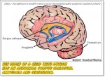Phát hiện mới về não bộ người Tự kỷ